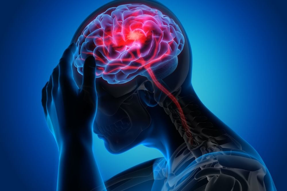 Ini Golongan Darah yang Paling Berisiko Kena Stroke