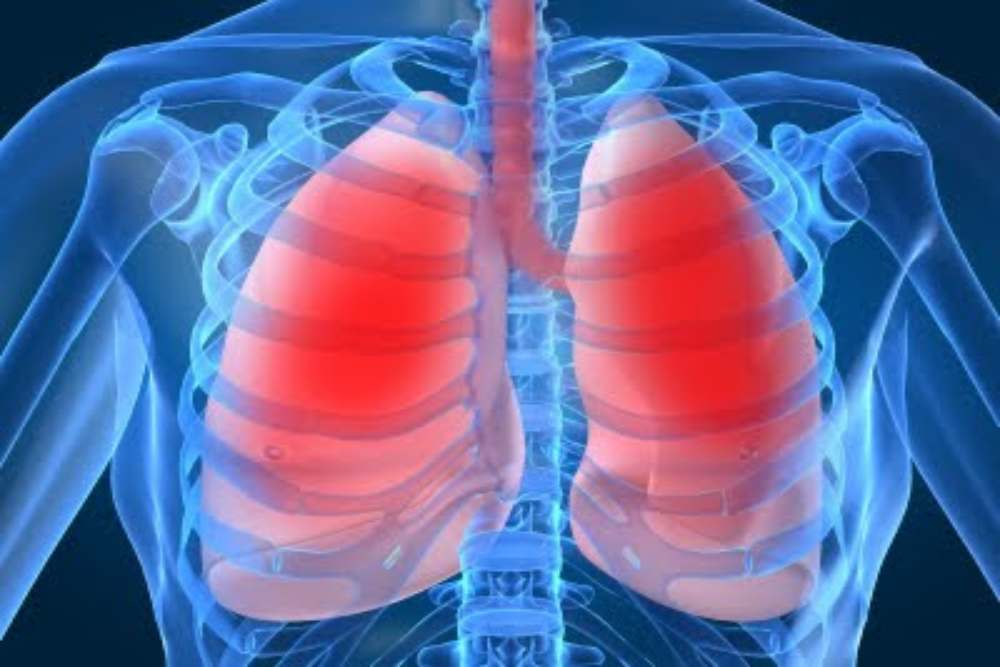 Hari Pneumonia Sedunia 2024: Ini 6 Gejala Pneumonia pada Lansia